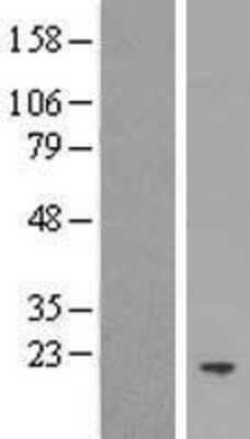 Western Blot: MORN5 Overexpression Lysate (Adult Normal) [NBP2-04706] Left-Empty vector transfected control cell lysate (HEK293 cell lysate); Right -Over-expression Lysate for MORN5.