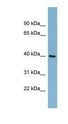 Western Blot: MOS Antibody [NBP1-58212] - NCI-H226 cell lysate, concentration 0.2-1 ug/ml.