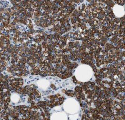 Immunohistochemistry-Paraffin: MOSC2 Antibody [NBP1-82167] - Staining of human parathyroid gland shows strong granular cytoplasmic positivity in glandular cells.