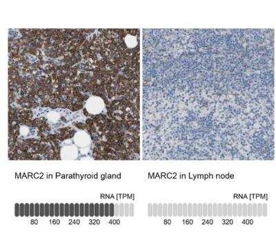 Immunohistochemistry-Paraffin: MOSC2 Antibody [NBP1-82167] - Analysis in human parathyroid gland and lymph node tissues using NBP1-82167 antibody. Corresponding MARC2 RNA-seq data are presented for the same tissues.