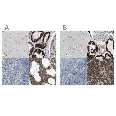 <b>Independent Antibodies Validation. </b>Immunohistochemistry-Paraffin: MOSC2 Antibody [NBP1-82168] - Staining of human cerebral cortex, kidney, lymph node and parathyroid gland using Anti-MARC2 antibody NBP1-82168 (A) shows similar protein distribution across tissues to independent antibody NBP1-82167 (B).