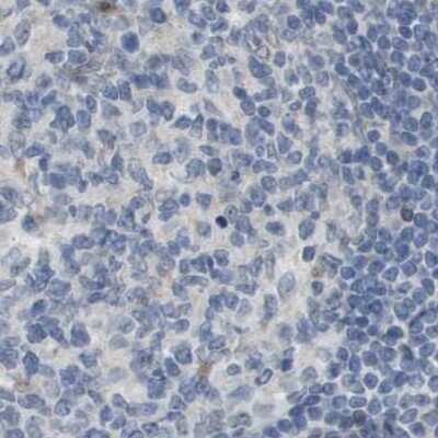 Immunohistochemistry-Paraffin: MOSC2 Antibody [NBP1-82168] - Staining of human lymph node using Anti-MARC2 antibody NBP1-82168.