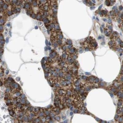 Immunohistochemistry-Paraffin: MOSC2 Antibody [NBP1-82168] - Staining of human parathyroid gland using Anti-MARC2 antibody NBP1-82168.