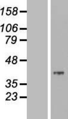Western Blot: MOSC2 Overexpression Lysate (Adult Normal) [NBL1-13190] Left-Empty vector transfected control cell lysate (HEK293 cell lysate); Right -Over-expression Lysate for MOSC2.