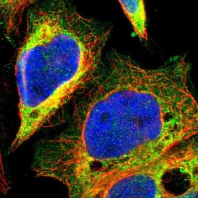 Immunocytochemistry/ Immunofluorescence MOSPD2 Antibody