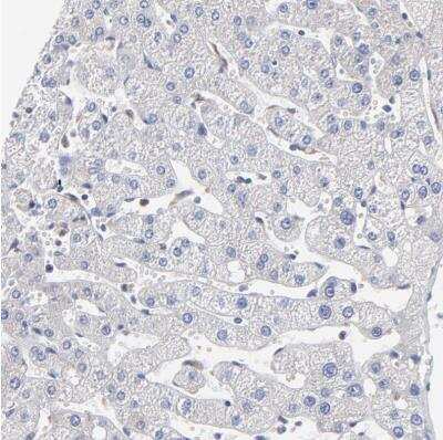 Immunohistochemistry-Paraffin MOSPD2 Antibody