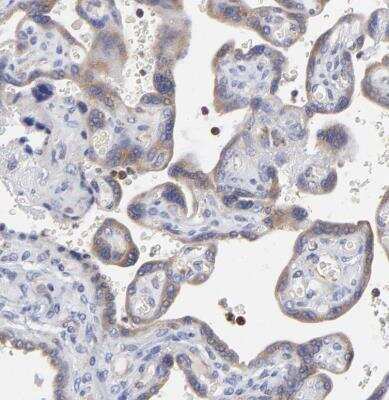 Immunohistochemistry-Paraffin MOSPD2 Antibody