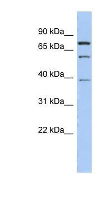 Western Blot: MOSPD2 Antibody [NBP1-91438] - Jurkat cell lysate, concentration 0.2-1 ug/ml.
