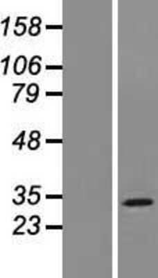 Western Blot: MOSPD3 Overexpression Lysate (Adult Normal) [NBP2-06362] Left-Empty vector transfected control cell lysate (HEK293 cell lysate); Right -Over-expression Lysate for MOSPD3.