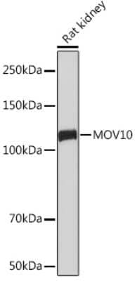 Western Blot: MOV10 Antibody (1M7M9) [NBP3-16654] - Western blot analysis of extracts of Rat kidney, using MOV10 Rabbit mAb (NBP3-16654) at 1:1000 dilution. Secondary antibody: HRP Goat Anti-Rabbit IgG (H+L) at 1:10000 dilution. Lysates/proteins: 25ug per lane. Blocking buffer: 3% nonfat dry milk in TBST. Detection: ECL Basic Kit. Exposure time: 60s.