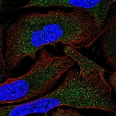 Immunocytochemistry/Immunofluorescence: MOV10 Antibody [NBP2-55081] - Staining of human cell line U-2 OS shows localization to cytosol.