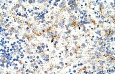 Immunohistochemistry-Paraffin: MOV10 Antibody [NBP1-57108] - Human Intestine Tissue, antibody concentration 4-8ug/ml. Cells with positive label: Epithelial cells of intestinal villus (indicated with arrows) 400X magnification.