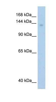 Western Blot: MOV10 Antibody [NBP1-57108] - Transfected 293T, Antibody Titration: 1.25ug/ml