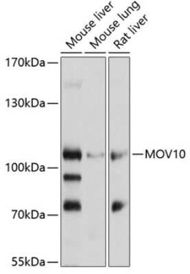 Western Blot: MOV10 Antibody [NBP2-94867] - Analysis of extracts of various cell lines, using MOV10 at 1:1000 dilution.Secondary antibody: HRP Goat Anti-Rabbit IgG (H+L) at 1:10000 dilution.Lysates/proteins: 25ug per lane.Blocking buffer: 3% nonfat dry milk in TBST.Detection: ECL Basic Kit .Exposure time: 30s.