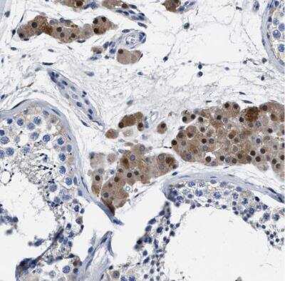 Immunohistochemistry-Paraffin MOV10L1 Antibody