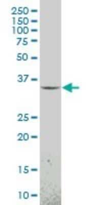 Western Blot: MOX1 Antibody (1F3) [H00004222-M23] - Analysis of MEOX1 expression in Y-79 (Cat # L042V1).