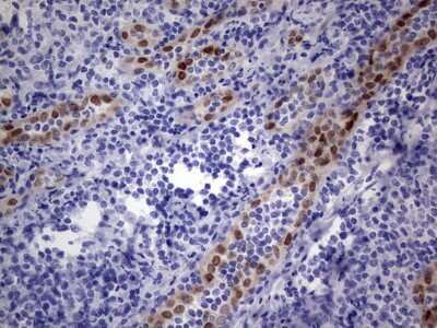 Immunohistochemistry: MOX1 Antibody (5B11) [NBP2-45819] - Analysis of Human tonsil tissue.