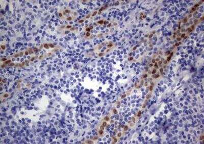 Immunohistochemistry-Paraffin: MOX1 Antibody (OTI5B11) - Azide and BSA Free [NBP2-72770] - Staining of Human tonsil within the normal limits using anti-MEOX1 Mouse monoclonal antibody. (heat-induced epitope retrieval by 1mM EDTA in 10mM Tris, pH8.5, 120 degrees C for 3min)
