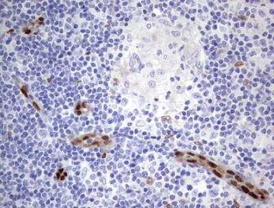 Immunohistochemistry-Paraffin: MOX1 Antibody (OTI5B11) - Azide and BSA Free [NBP2-72770] - Staining of Human lymph node tissue within the normal limits using anti-MEOX1 Mouse monoclonal antibody. ( heat-induced epitope retrieval by 1mM EDTA in 10mM Tris, pH8.5, 120 degrees C for 3min)