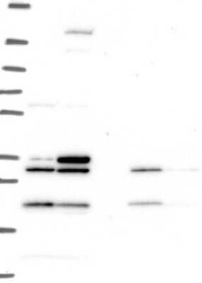 Western Blot: MOX1 Antibody [NBP3-17639] - Lane 1: Marker [kDa] 250, 130, 95, 72, 55, 36, 28, 17, 10;   Lane 2: RT4;   Lane 3: U-251 MG;   Lane 4: Human Plasma;   Lane 5: Liver;   Lane 6: Tonsil