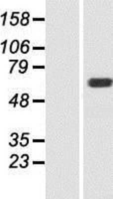 Western Blot: MOXD1 Overexpression Lysate (Adult Normal) [NBP2-07158] Left-Empty vector transfected control cell lysate (HEK293 cell lysate); Right -Over-expression Lysate for MOXD1.
