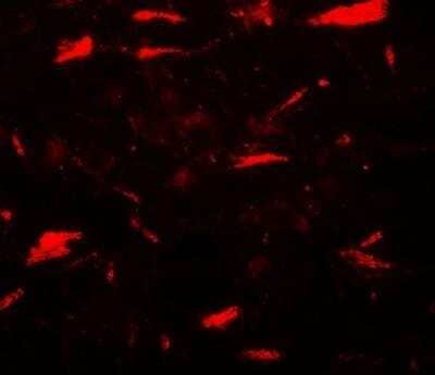 Immunocytochemistry/Immunofluorescence: MP1/MAP2K1IP1 Antibody [NBP2-81886] - Analysis of MP1/MAP2K1IP1 in human brain tissue with MP1/MAP2K1IP1 antibody at 20 ug/ml.