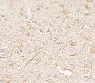 Immunohistochemistry: MP1/MAP2K1IP1 Antibody [NBP2-81886] - Analysis of MP1/MAP2K1IP1 in human brain tissue with MP1/MAP2K1IP1 antibody at 5 ug/ml.