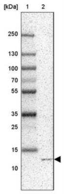 Western Blot: MP1/MAP2K1IP1 Antibody [NBP1-87837] - Lane 1: Marker  [kDa] 250, 130, 100, 70, 55, 35, 25, 15, 10.  Lane 2: SK-MEL-30