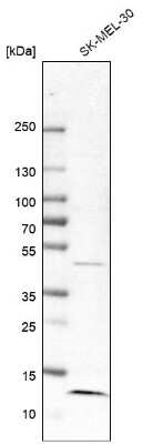 Western Blot: MP1/MAP2K1IP1 Antibody [NBP1-87837] - Analysis in human cell line SK-MEL-30.