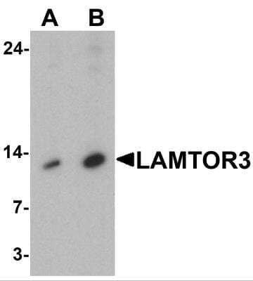 Western Blot: MP1/MAP2K1IP1 Antibody [NBP2-81886] - Analysis of MP1/MAP2K1IP1 in human brain tissue lysate with MP1/MAP2K1IP1 antibody at (A) 1 and (B) 2 ug/ml.