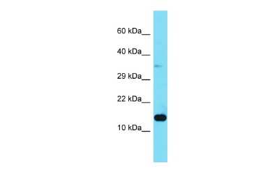 Western Blot: MP1/MAP2K1IP1 Antibody [NBP2-87818] - Host: Rabbit. Target Name: LAMTOR3. Sample Type: 293T Whole Cell lysates. Antibody Dilution: 1.0ug/mlLAMTOR3 is supported by BioGPS gene expression data to be expressed in HEK293T