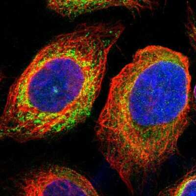 Immunocytochemistry/Immunofluorescence: MPDU1 Antibody [NBP1-84570] - Immunofluorescent staining of human cell line A-431 shows localization to endoplasmic reticulum.