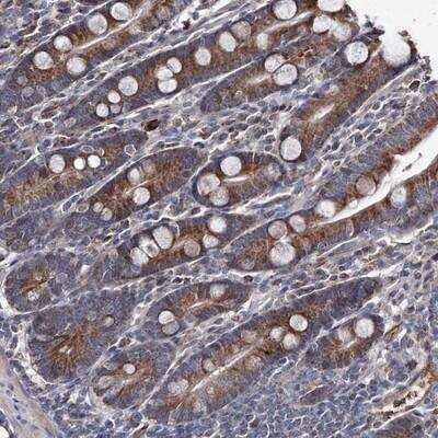 Immunohistochemistry-Paraffin: MPHOSPH1 Antibody [NBP1-88042] - Staining of human duodenum shows moderate cytoplasmic positivity in glandular cells.