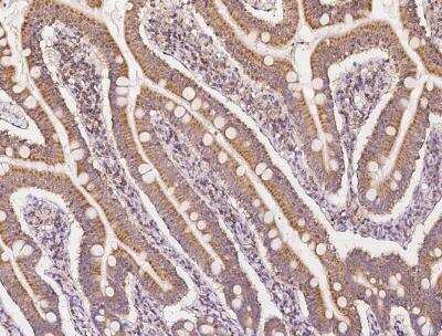 Immunohistochemistry-Paraffin MPHOSPH1 Antibody