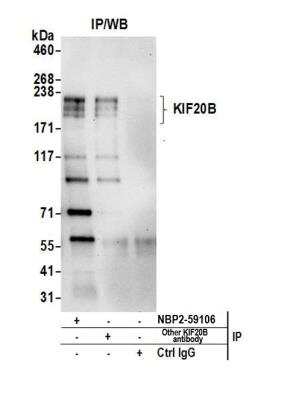 MPHOSPH1 Antibody [NBP2-59106] - Detection of human KIF20B by western blot of immunoprecipitates. Samples: Whole cell lysate (0.5 or 1.0 mg per IP reaction; 20% of IP loaded) from 293T cells prepared using NETN lysis buffer. Antibodies: Affinity purified rabbit anti-KIF20B antibody NBP2-59106 used for IP at 8 ul per reaction. KIF20B was also immunoprecipitated by another rabbit anti-KIF20B antibody. For blotting immunoprecipitated KIF20B, NBP2-59106 was used at 1:1000. Detection: Chemiluminescence with an exposure time of 30 seconds.