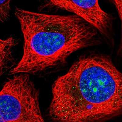 Immunocytochemistry/Immunofluorescence: MPHOSPH10 Antibody [NBP2-55783] - Staining of human cell line U-2 OS shows localization to nucleoli.