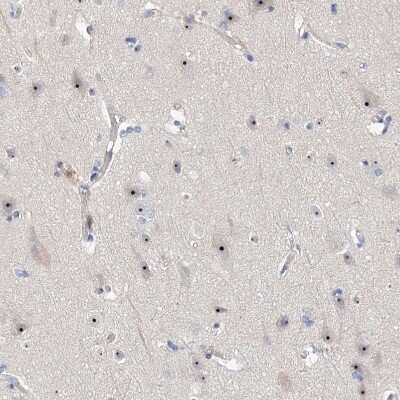 Immunohistochemistry-Paraffin: MPHOSPH10 Antibody [NBP2-38232] - Staining of human cerebral cortex shows strong positivity in nucleoli in neurons.