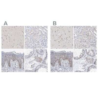<b>Independent Antibodies Validation. </b>Immunohistochemistry-Paraffin: MPHOSPH10 Antibody [NBP2-38232] - Staining of human cerebral cortex, kidney, skin and testis using Anti-MPHOSPH10 antibody NBP2-38232 (A) shows similar protein distribution across tissues to independent antibody NBP1-84341 (B).