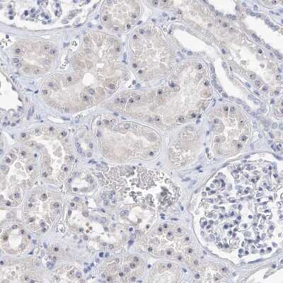 Immunohistochemistry-Paraffin: MPHOSPH10 Antibody [NBP2-38232] - Staining of human kidney shows moderate positivity in nucleoli in cells in tubules.