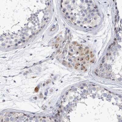 Immunohistochemistry-Paraffin: MPHOSPH10 Antibody [NBP2-38232] - Staining of human testis shows strong positivity in nucleoli in Leydig cells.