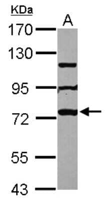 Western Blot: MPHOSPH10 Antibody [NBP2-19387] - Sample (30 ug of whole cell lysate) A: MCF-7 7. 5% SDS PAGE gel, diluted at 1:1000.