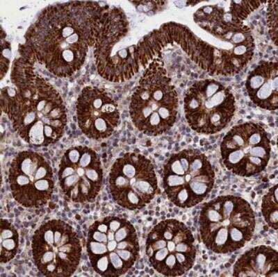 Immunohistochemistry-Paraffin: MPND Antibody [NBP2-31009] - Staining of human colon shows strong granular cytoplasmic positivity in glandular cells.