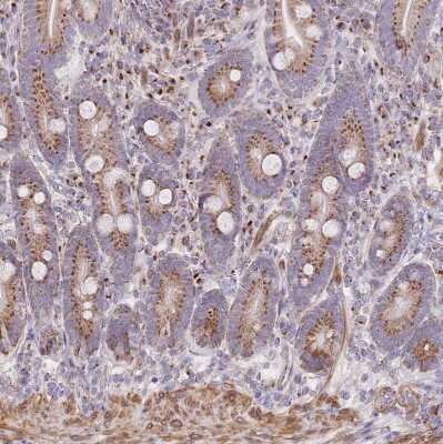 Immunohistochemistry-Paraffin: MPND Antibody [NBP2-30571] - Staining of human duodenum shows strong cytoplasm granular positivity in glandular cells.