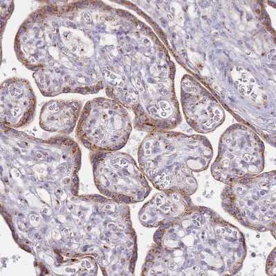 Immunohistochemistry-Paraffin: MPND Antibody [NBP2-30571] - Staining of human placenta shows strong cytoplasm granular positivity in in trophoblastic cells.