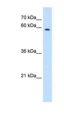 Western Blot: MPND Antibody [NBP1-79263] - Titration: 2.5ug/ml Positive Control: HepG2 cell lysate.