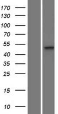 Western Blot MPND Overexpression Lysate