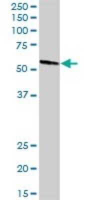 Western Blot: MPP1 Antibody [H00004354-D01P] - Analysis of MPP1 expression in mouse kidney.