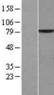 Western Blot PALS1/MPP5 Overexpression Lysate