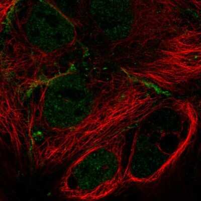Immunocytochemistry/ Immunofluorescence MPP7 Antibody - BSA Free