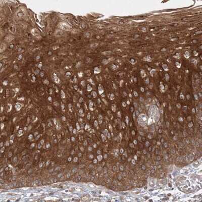 <b>Orthogonal Strategies Validation. </b>Immunohistochemistry-Paraffin: MPP7 Antibody [NBP1-81989] - Staining of human esophagus shows high expression.